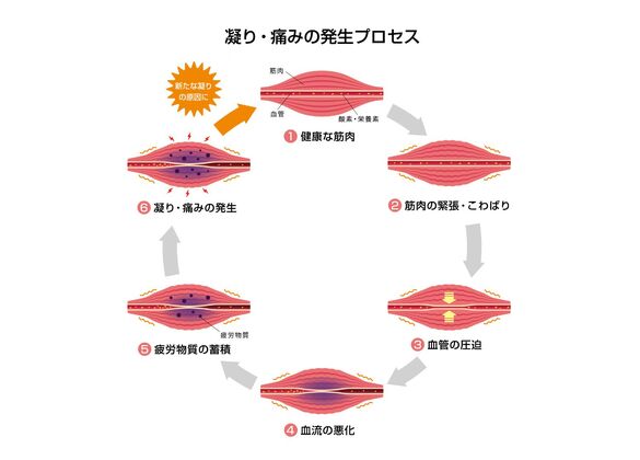 痛みの発生