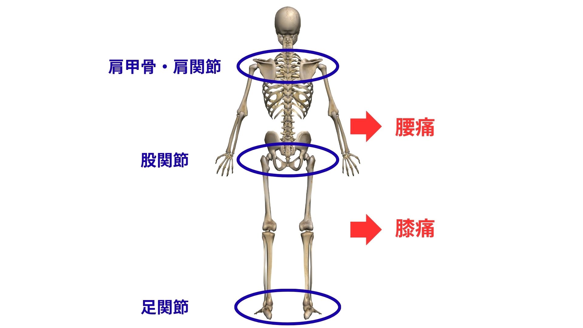 膝痛の引き金３