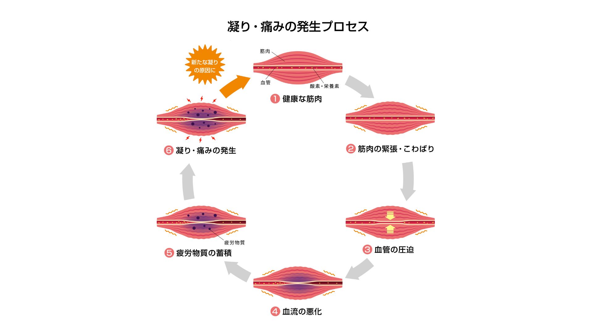 痛みの発生